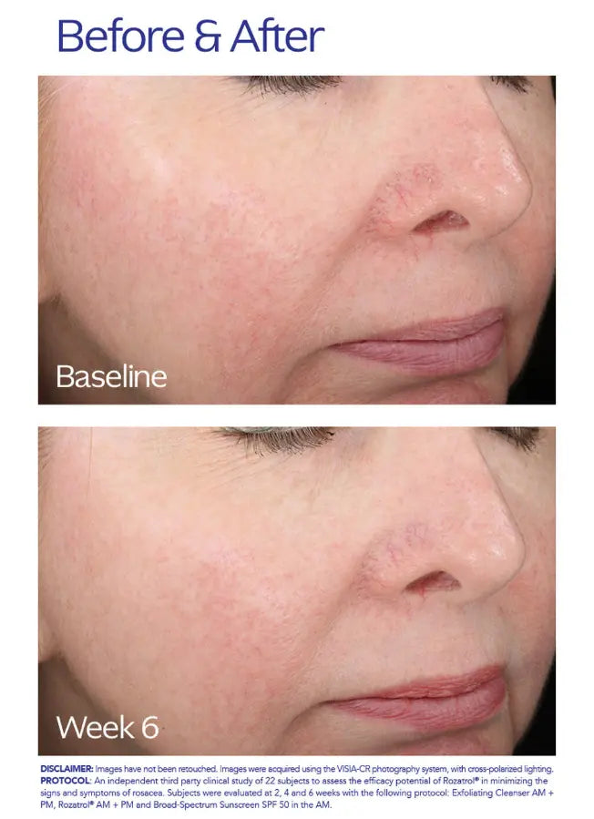 Rozatrol 50ml Elda Silva Shop