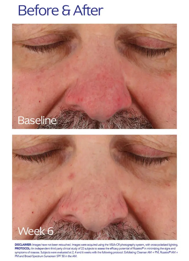 Rozatrol 50ml Elda Silva Shop