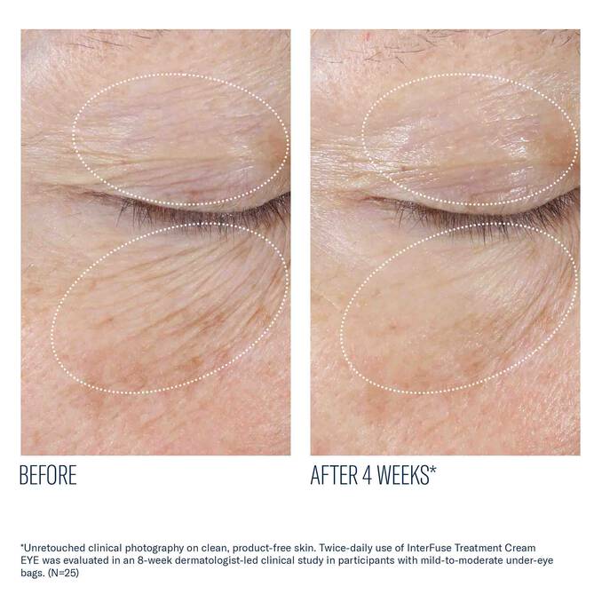 InterFuse Treatment Cream EYE 15ml